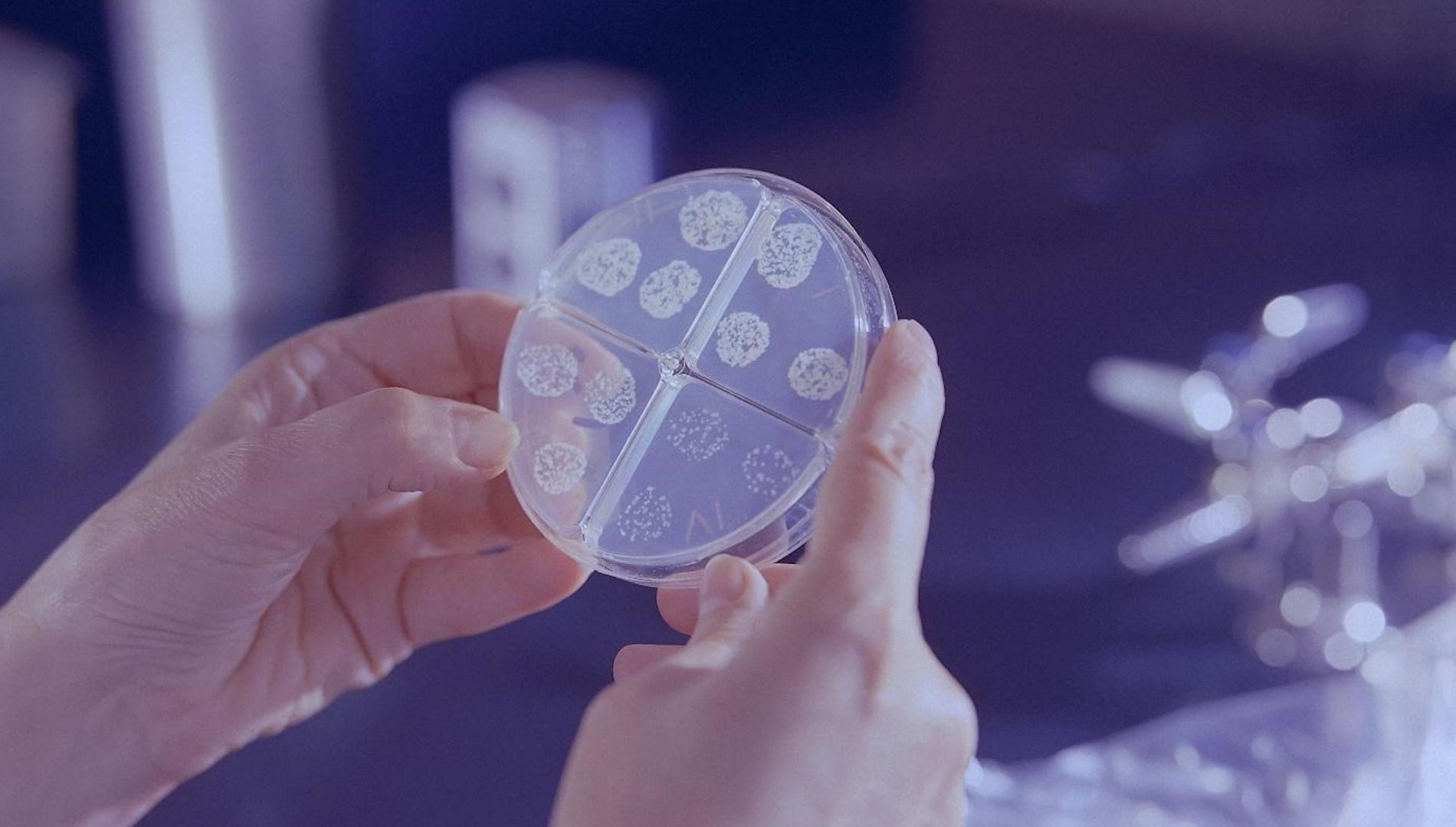 Scientist's hand holding a petri dish with microbes