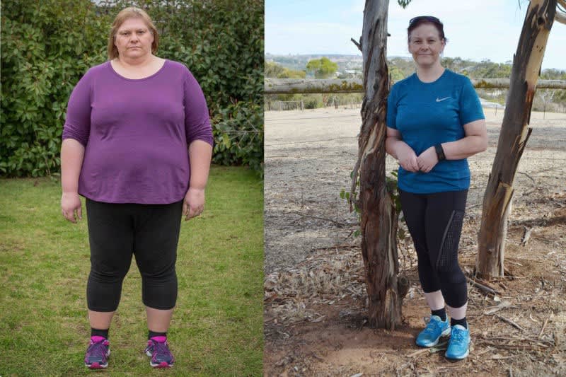 Weight loss changed Jacqui's life