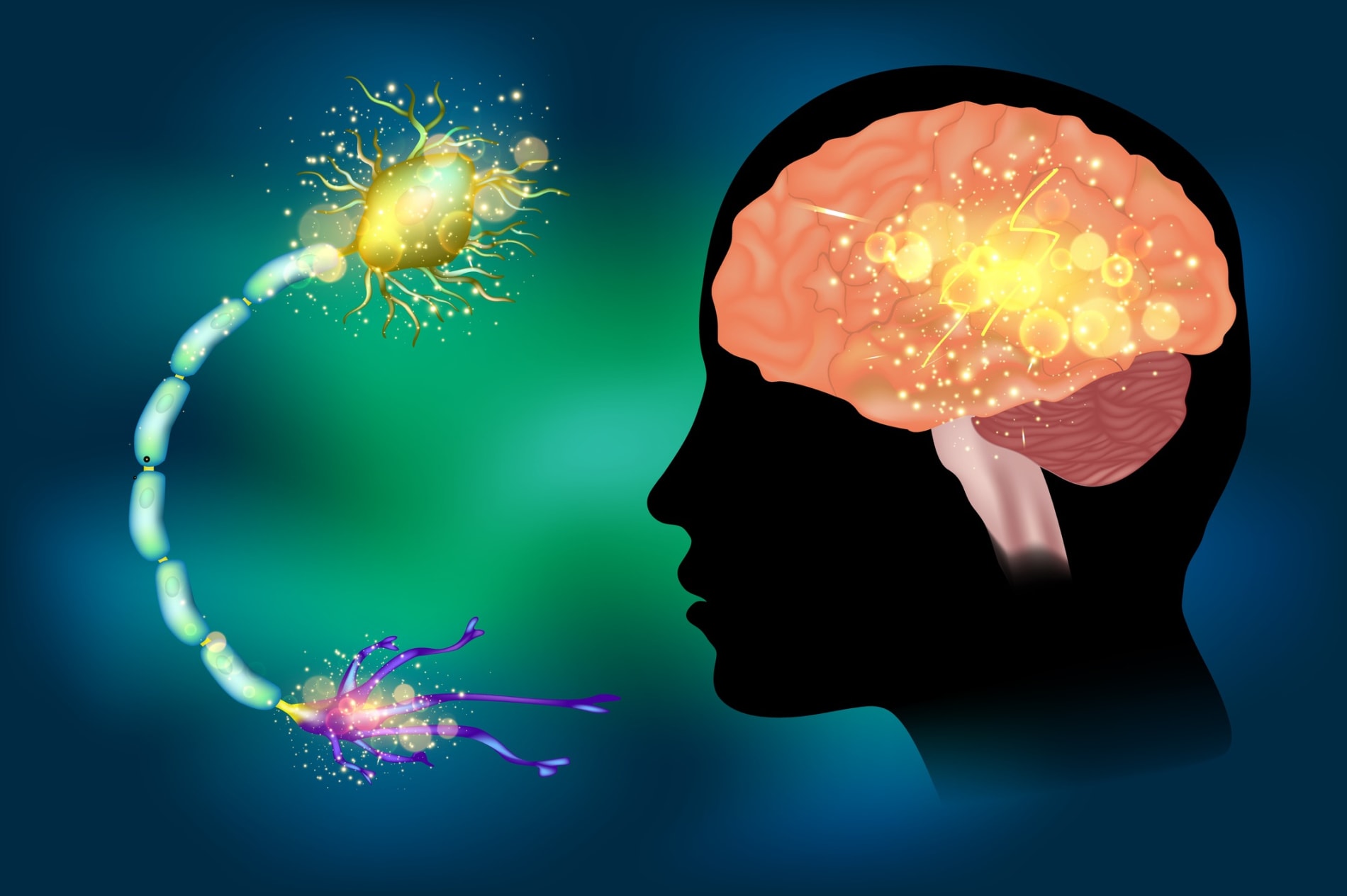 Seizures epilepsy. Anatomy of brain, electrical discharge.