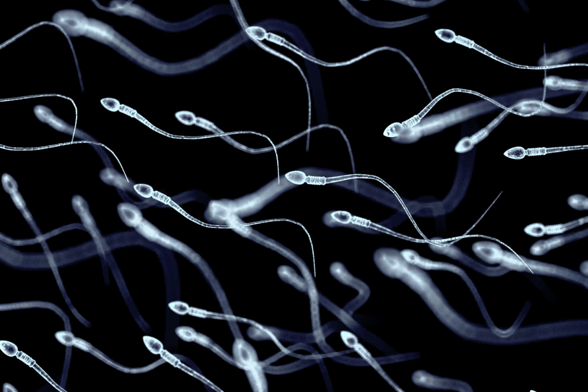 Swimming sperm 