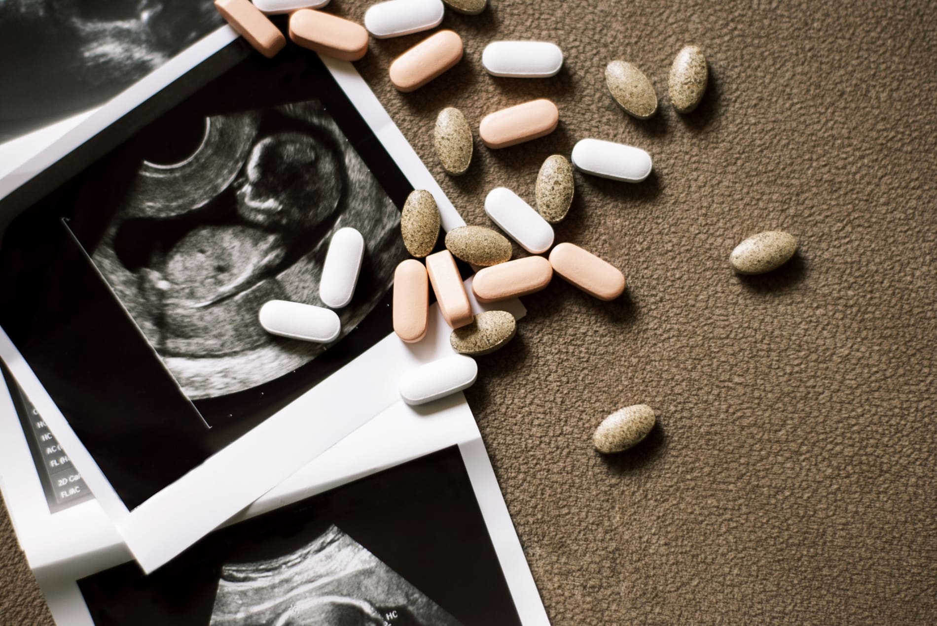 Ultrasound images of a foetus with scattered pills on brown background. 