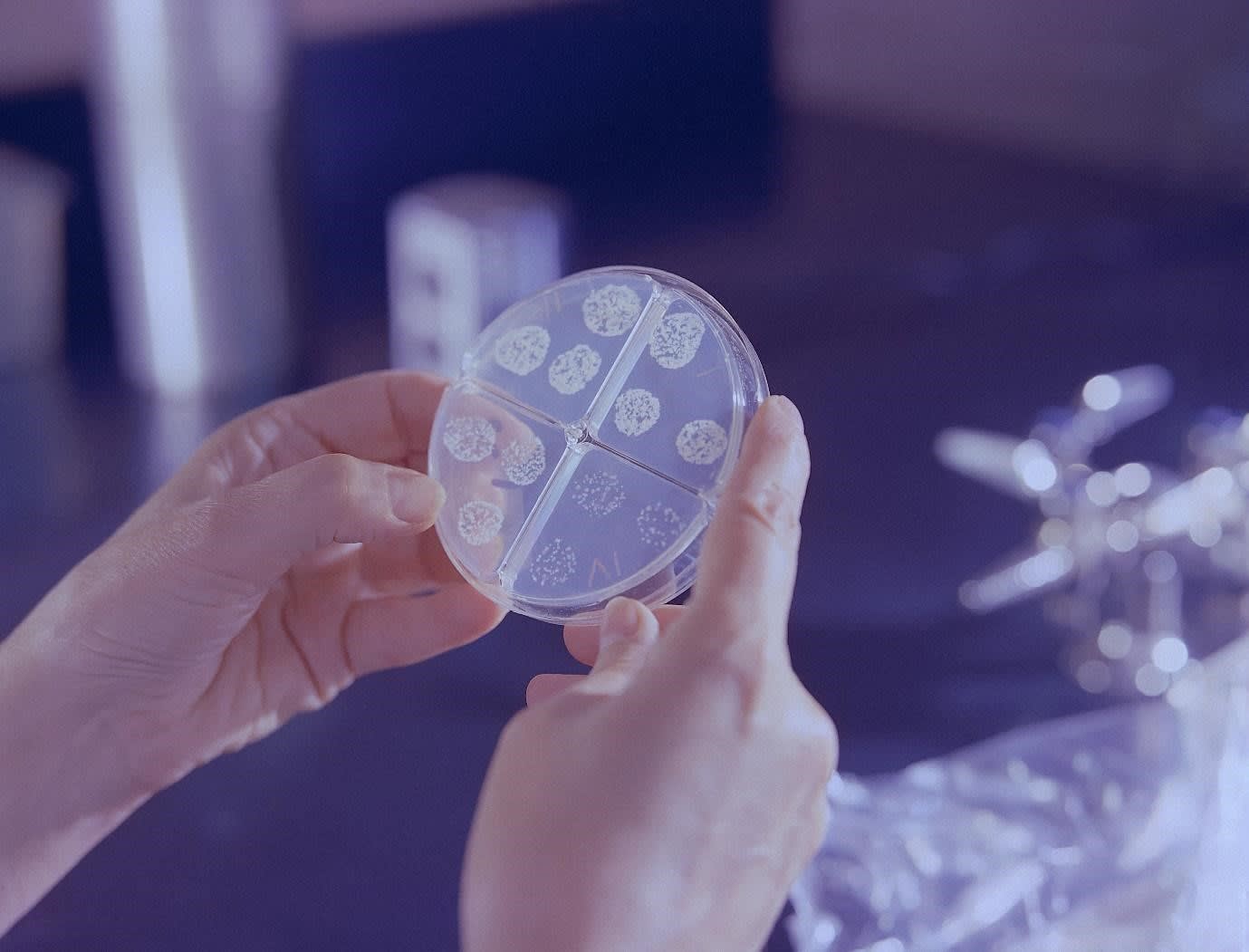 Scientist's hand holding a petri dish with microbes