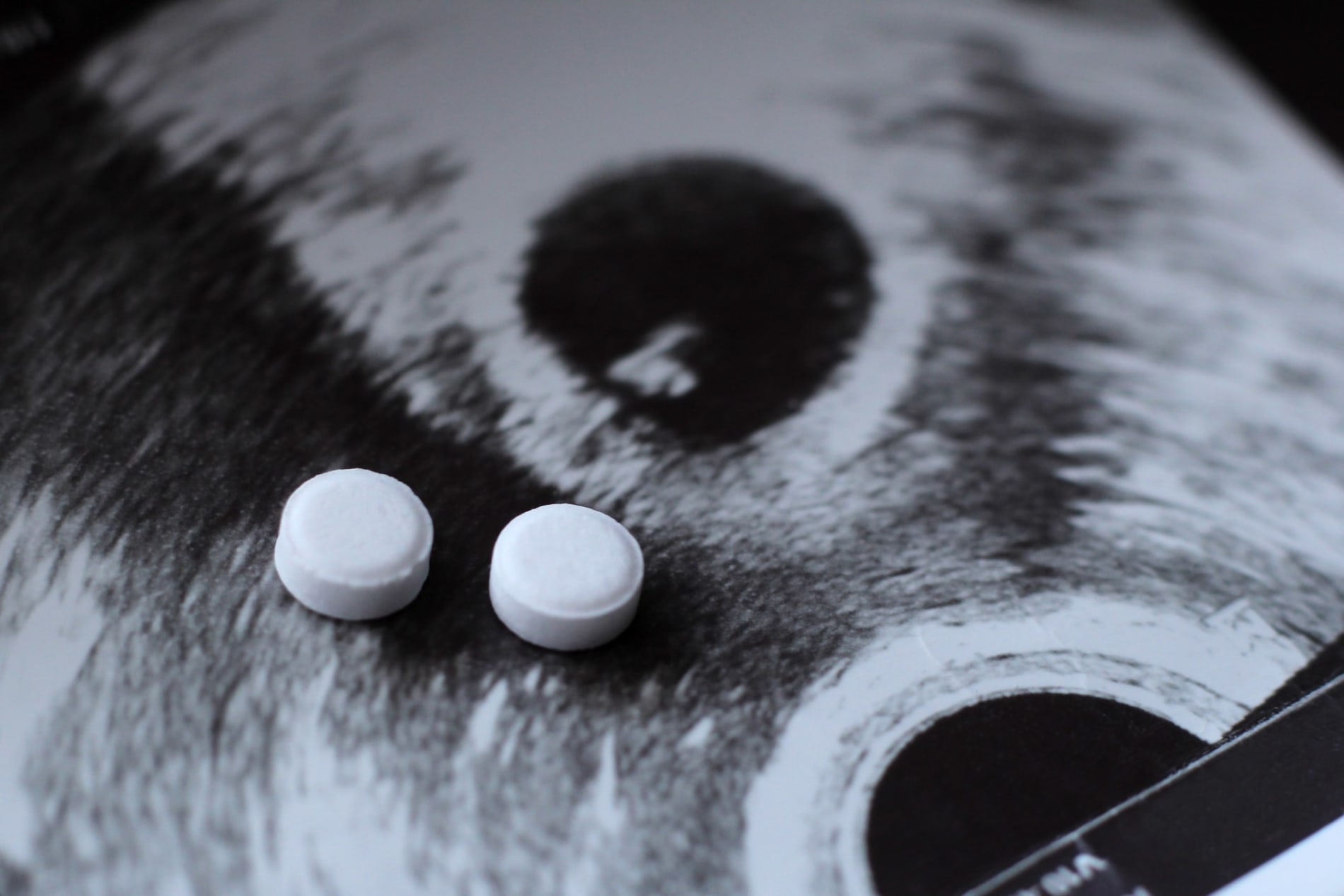 Ultrasound image of a pregnancy, with two pills sitting on it, implying medical abortion options