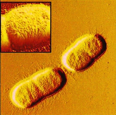 Acinetobacter baumannii