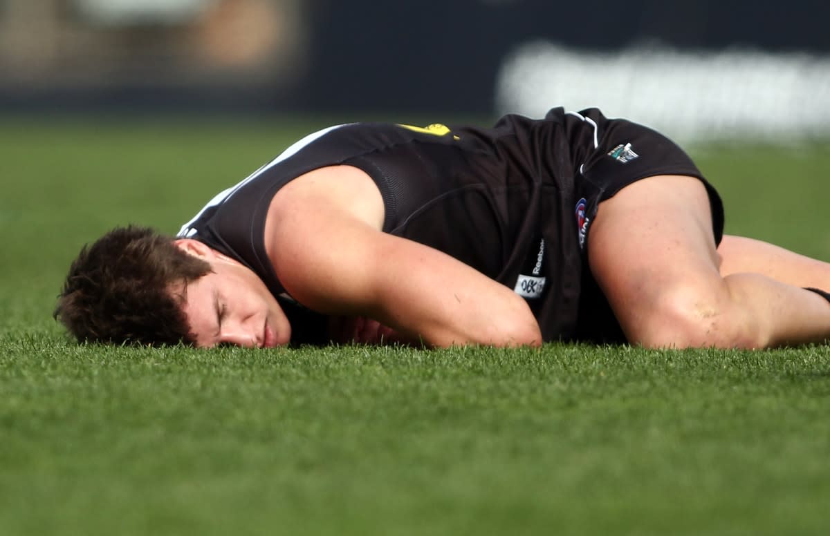 Picture of AFL player prone on the ground after head knock