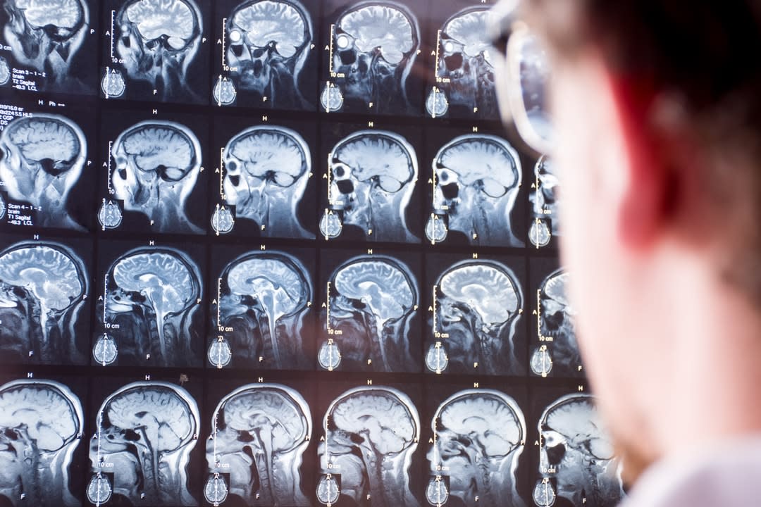 Doctor in foreground with blurred silhouette looks at magnetic resonance imaging of brain of patient in background in focus.