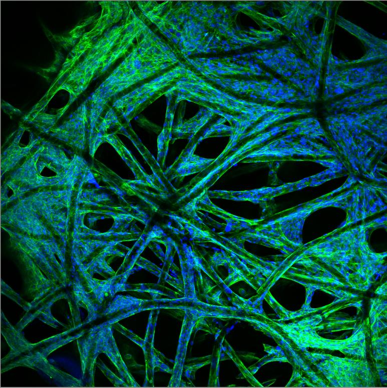 Stromal cells, important in immune response, grown on a 3D-printed scaffold with the cytoskeleton (holding the cells together). shown in green and the cell nuclei stained blue
