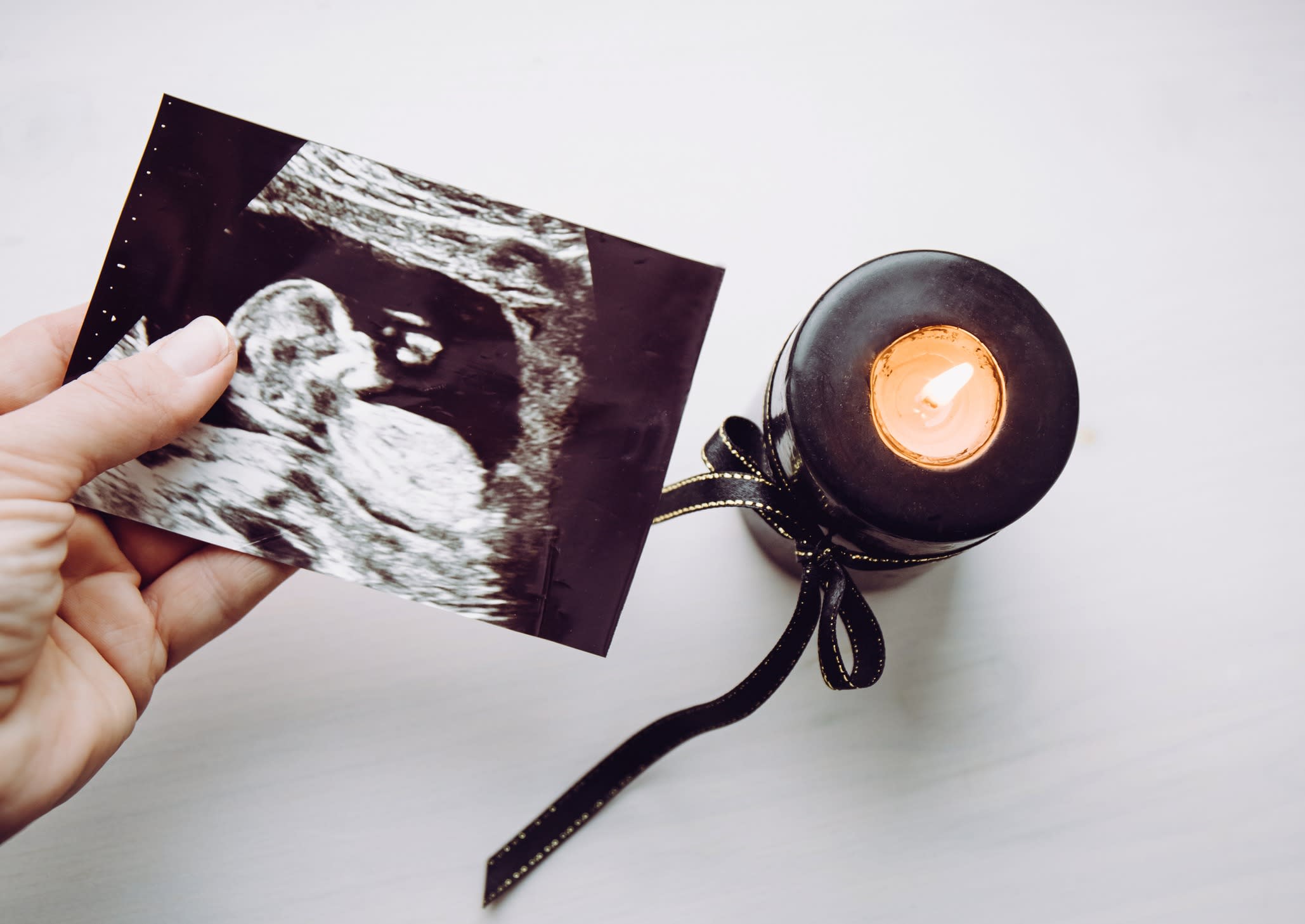 Conceptual image of woman mourning, miscarriage. Mother hand holding ultrasound picture of baby. Black candle with black ribbon burning.