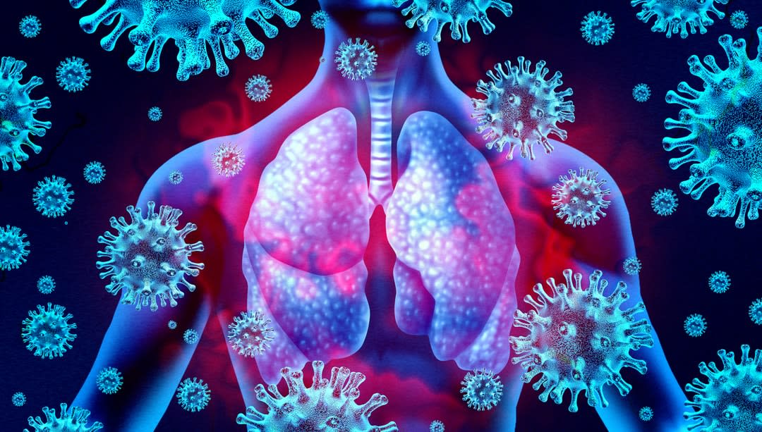 Lung Virus Infection concept.