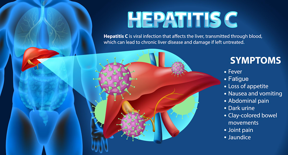 Informative Symptoms of Hepatitis C