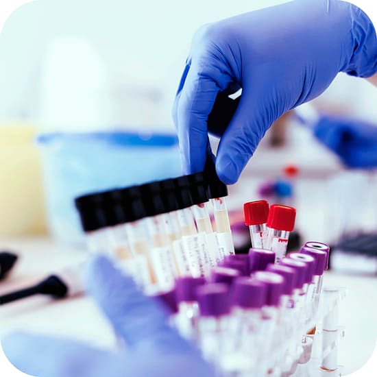 Q&A blog: Streamlining forensic toxicology workflows for smarter drug screening and confirmation
