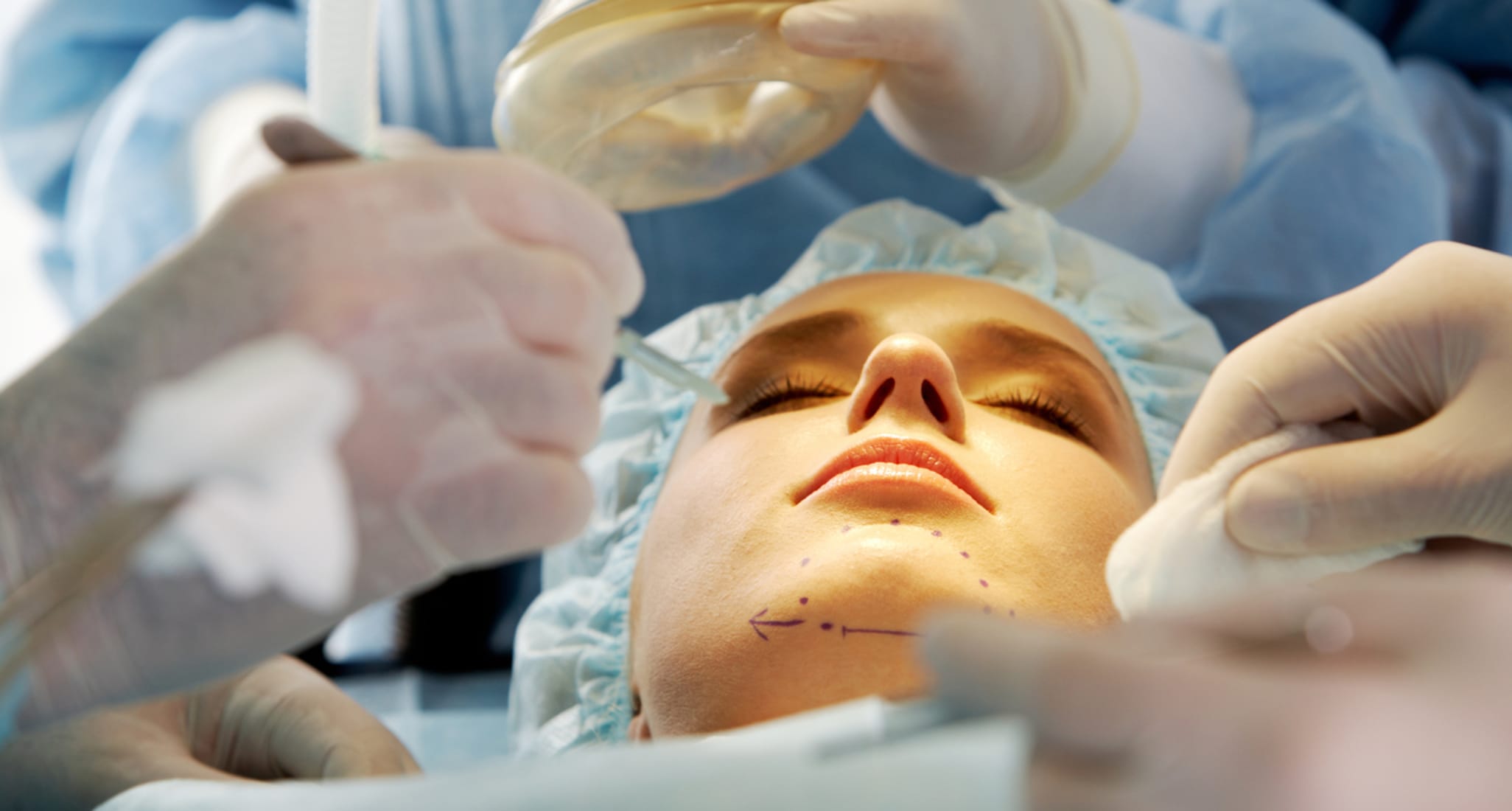 Before a cosmetic procedure you must clarify whether your basic insurance covers the costs.