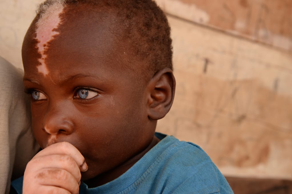 A close-up picture of Shakul wearing a blue t-shirt and sucking his thumb. He is looking away from the camera.