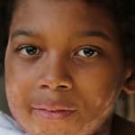 Links to A horrific attack by fire: One year later