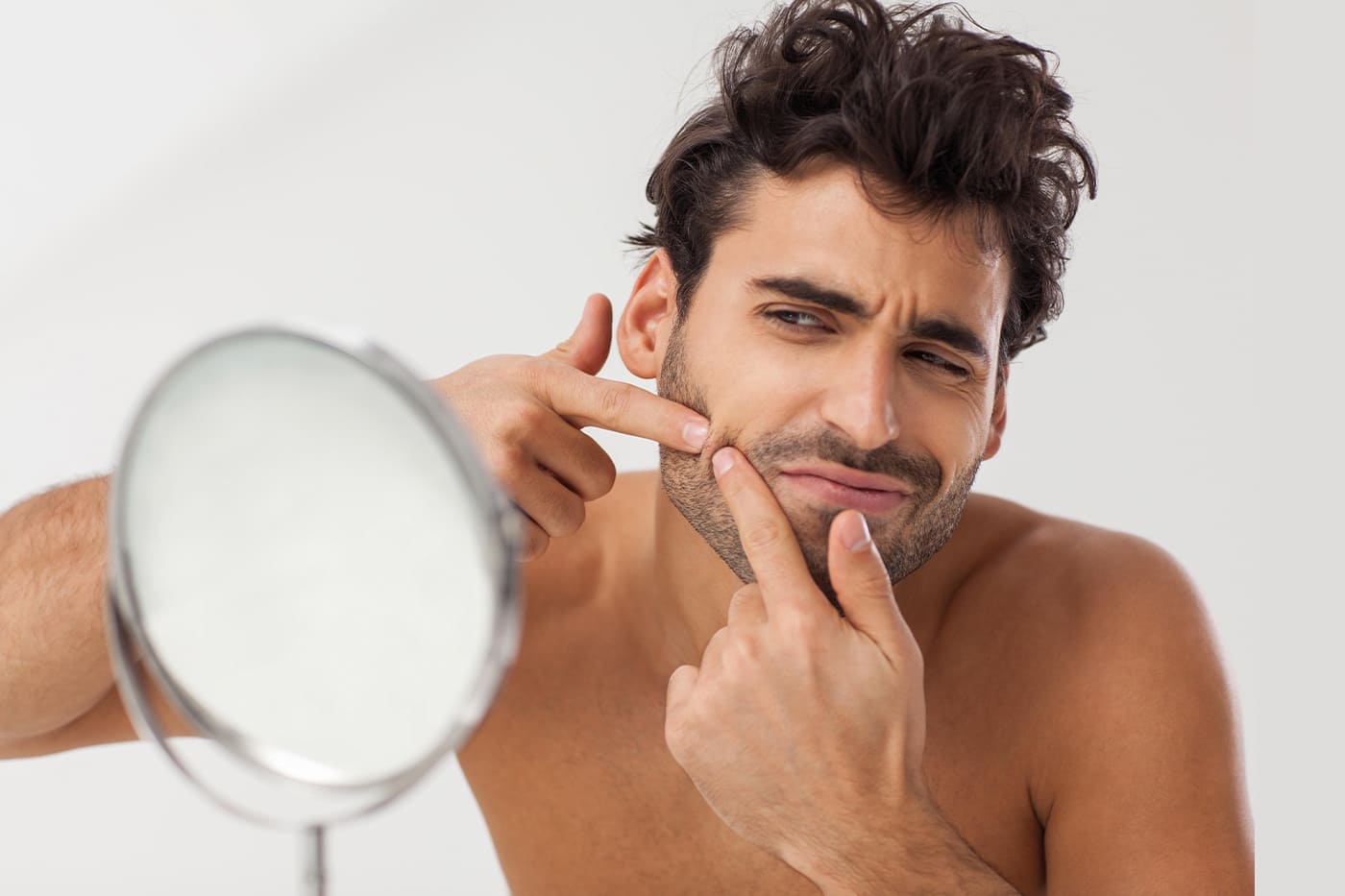 Treating male acne the right way