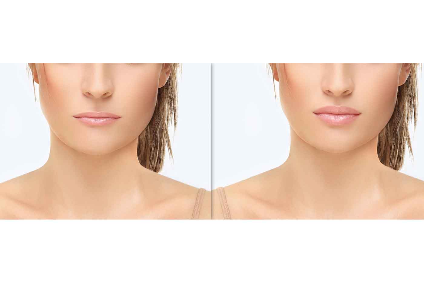 difference between Thin lips and fuller lips