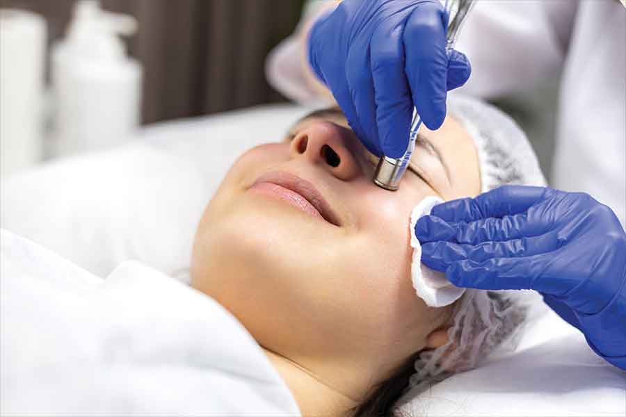 Microdermabrasion treatment - The perfect bridal glow-up