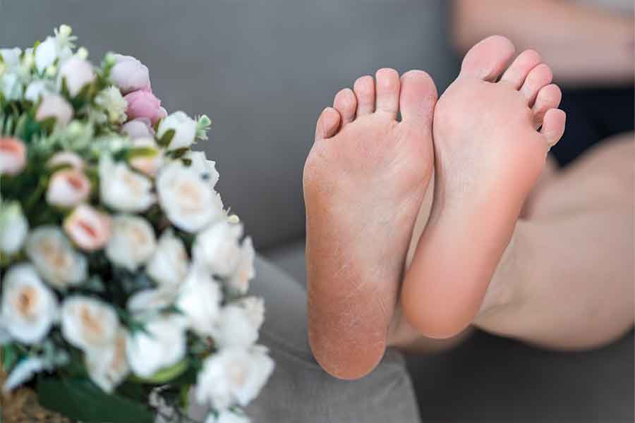 Pedicure Tips for Dry Feet