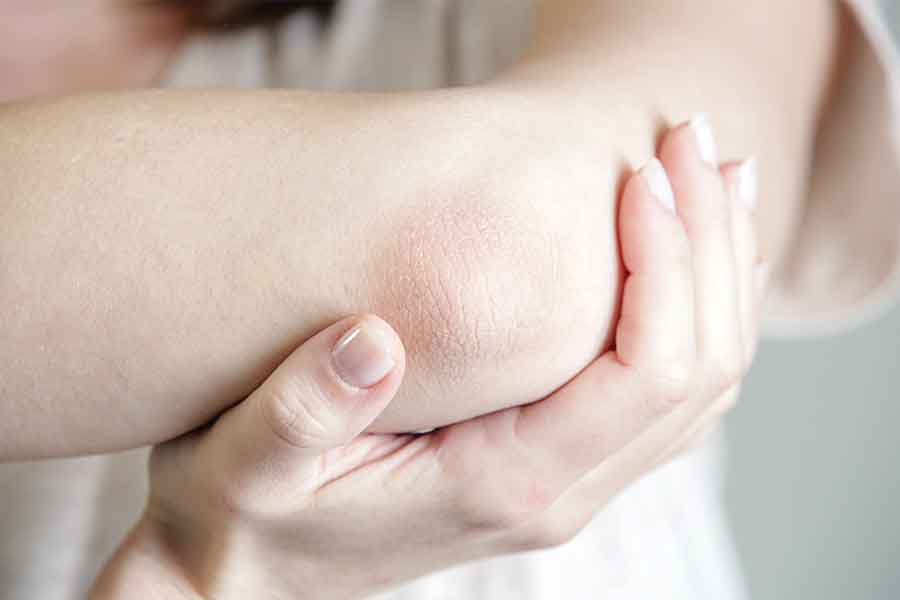 Oral supplements for winter dry skin