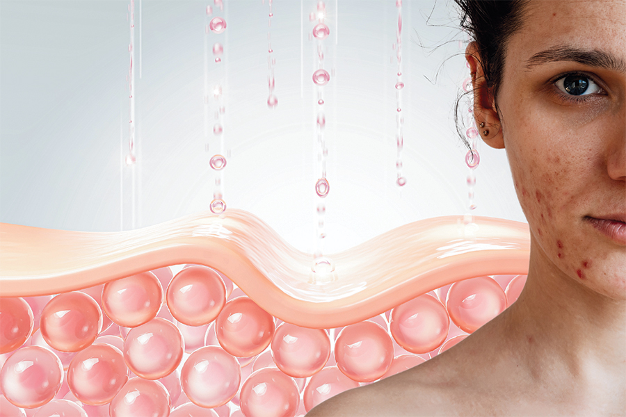 Skin Barrier Breakthrough