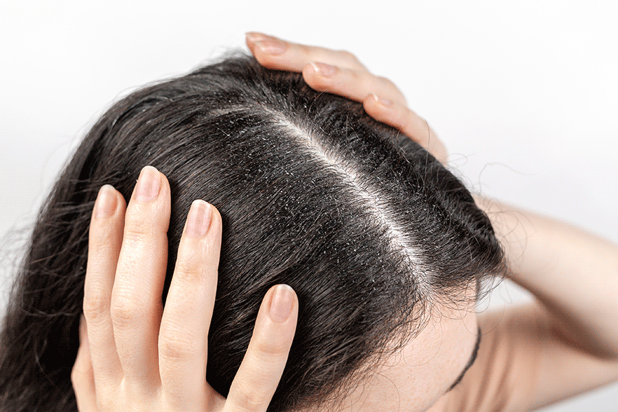 Understanding Scalp Health