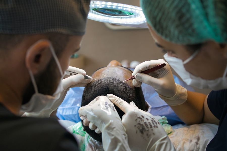 Turkish Hair Transplant Expert and Mister Hair Partner To Introduce State-of-the-Art Hair Restoration Techniques in India