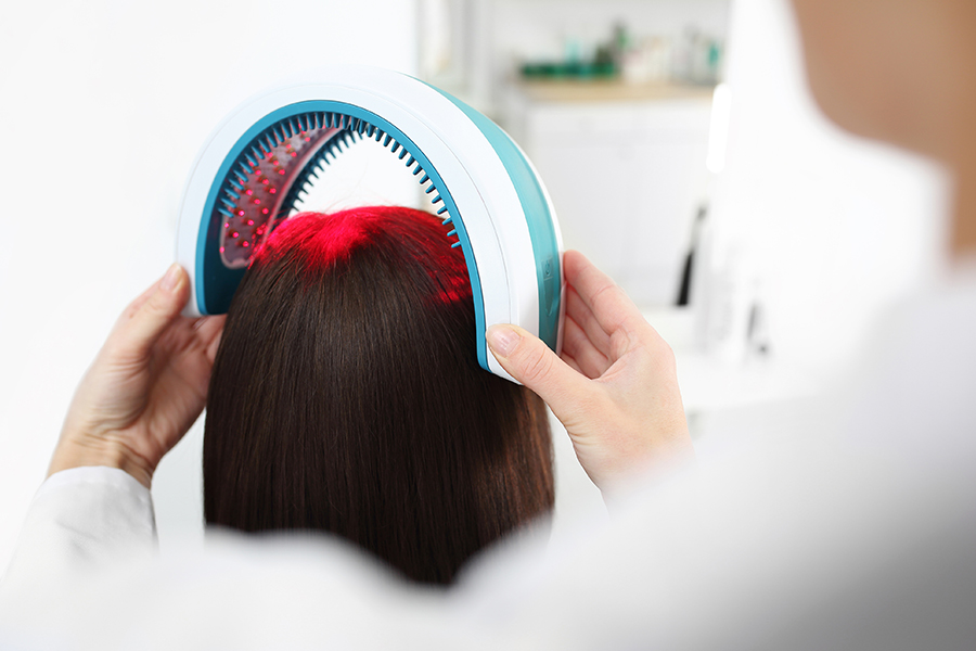 Laser Scalp Therapy