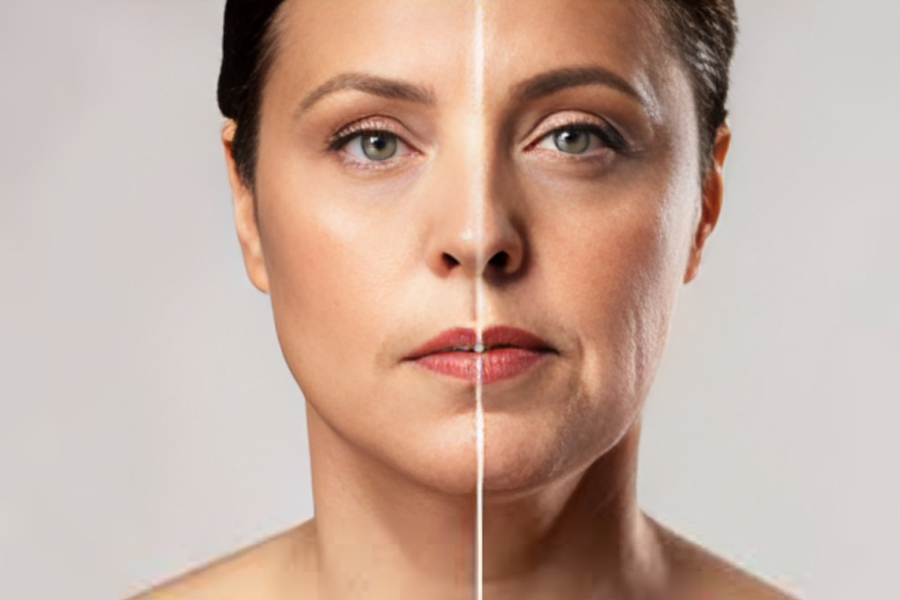 Collagen Supplements Improve Skin Health but Not Wrinkles