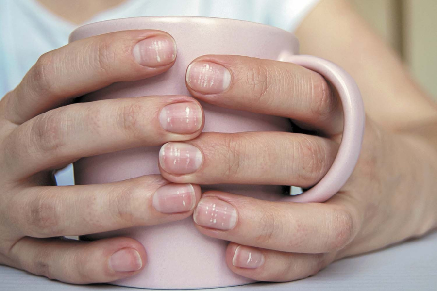 Vitamin D Deficiency Signs