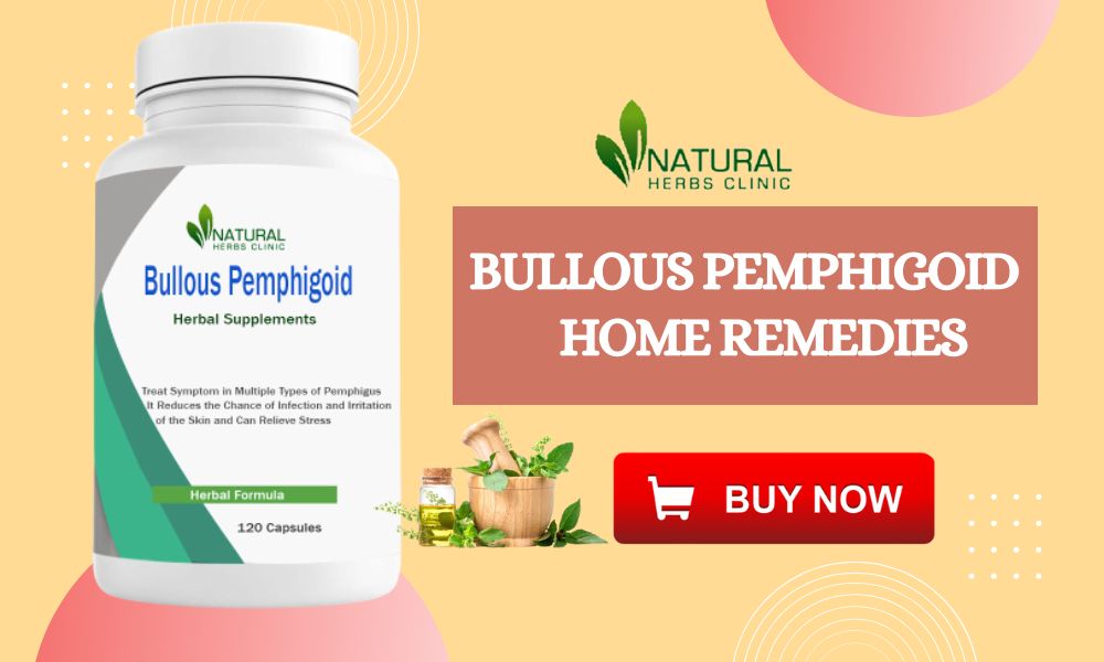 Natural Treatment for Bullous Pemphigoid