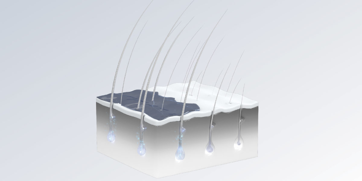 Scalp 3D Technology Visualisation