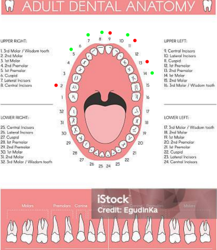 my Teeth