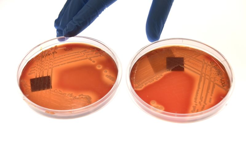 Jean Lee, a PhD student at Melbourne's Doherty Institute, displays the superbug Staphylcocus epidermidis on an agar plate in Melbourne on September 4, 2018.