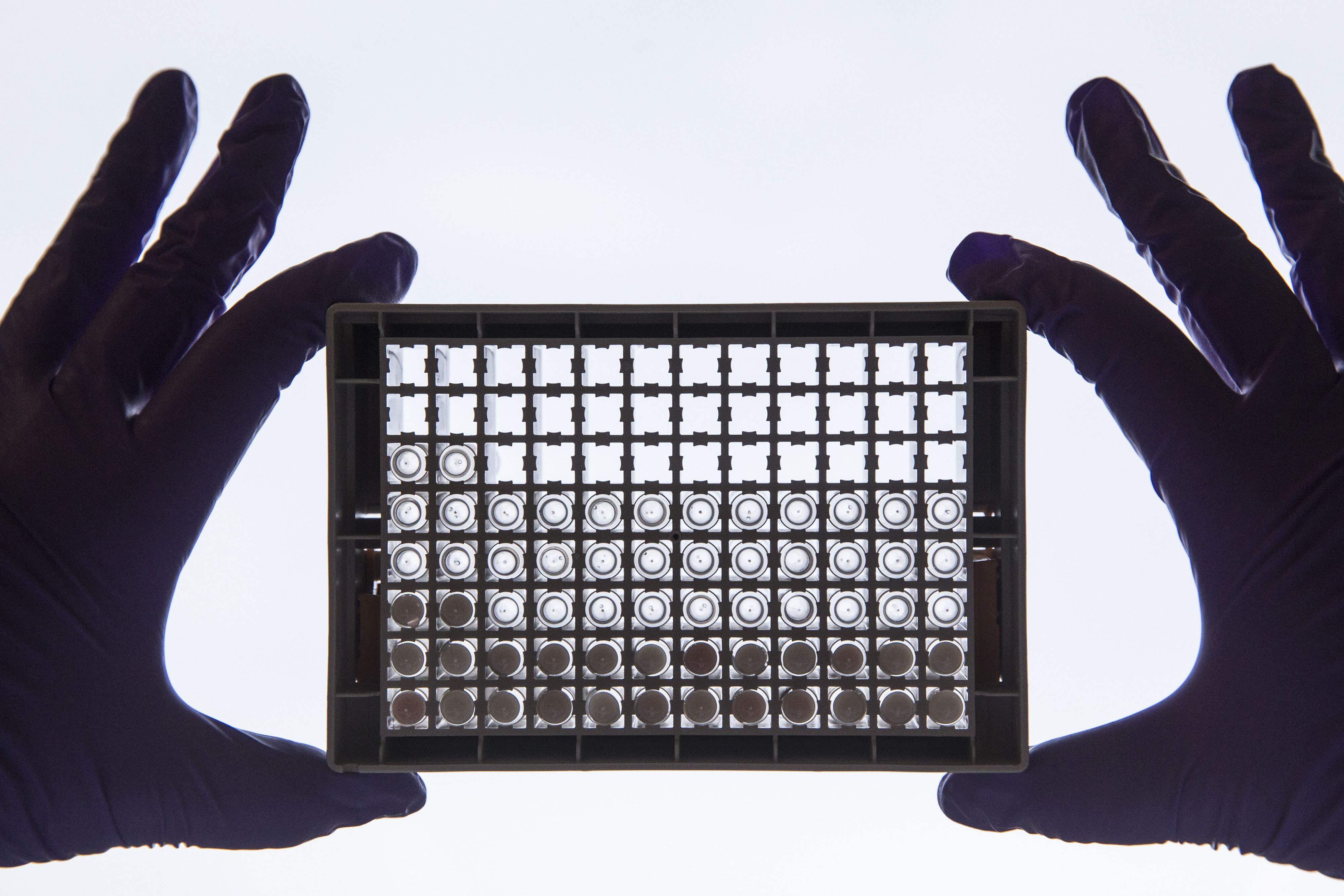 A scientist examining cells in a 96-well plate. A scientist examining cells in a 96-well plate.