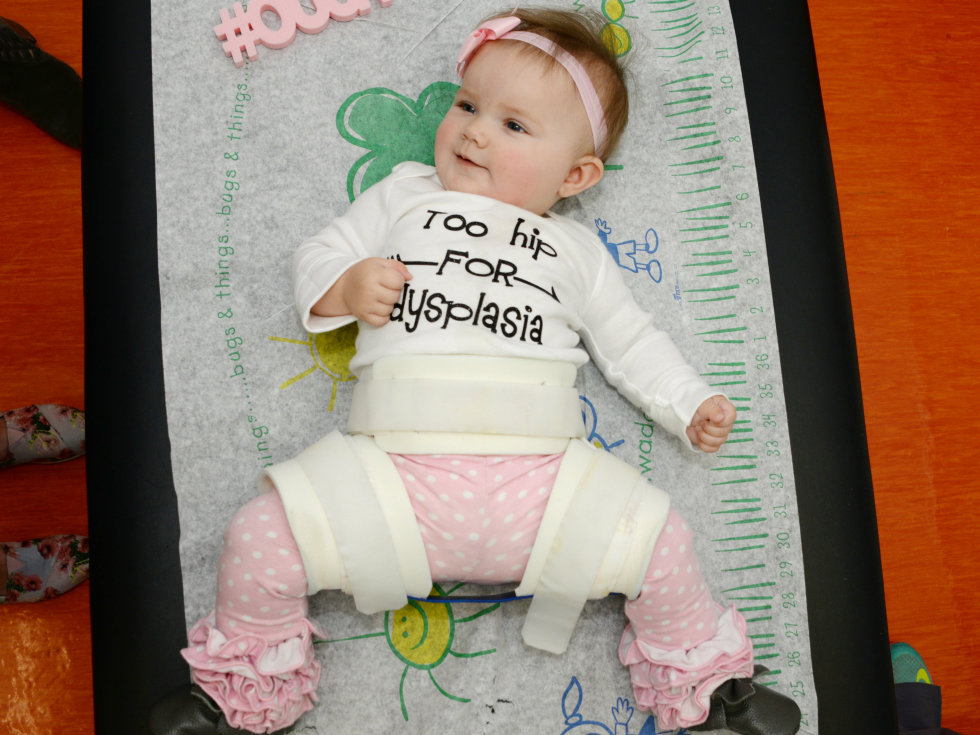 Baby being treated for hip dysplasia