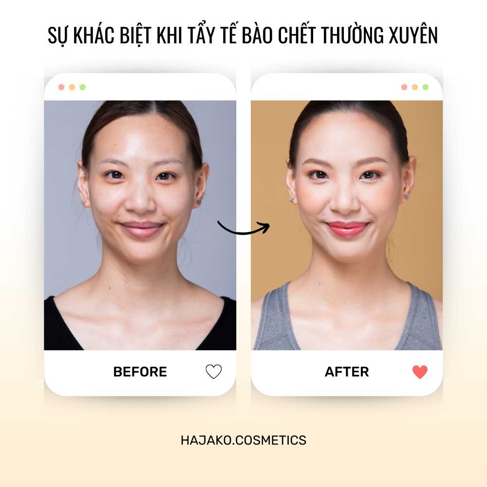 Tẩy Tế Bào Chết Da Mặt ANJO Professional Skin Soft Peeling Gel 180ML - Product image