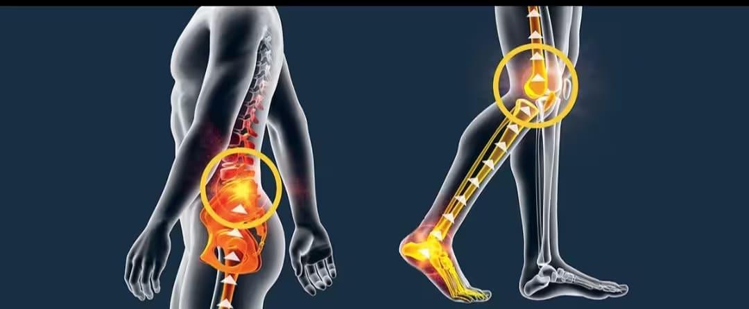 Diagram showing how foot pain can radiate to the knee and spine