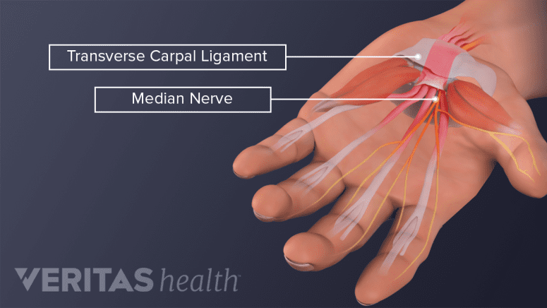 Hand and Wrist Injuries