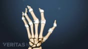 Medical illustration of the bones of the hand showing arthritis in the fingers