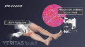 Knee aspirations and fluid being examined under a microscope
