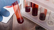 Vials of blood in a holder and one being inspected