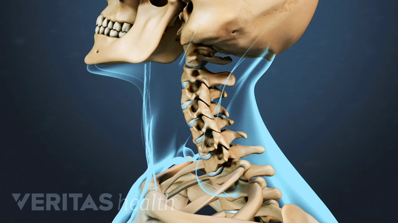 Stiff Neck Causes Symptoms and Treatment Spine health