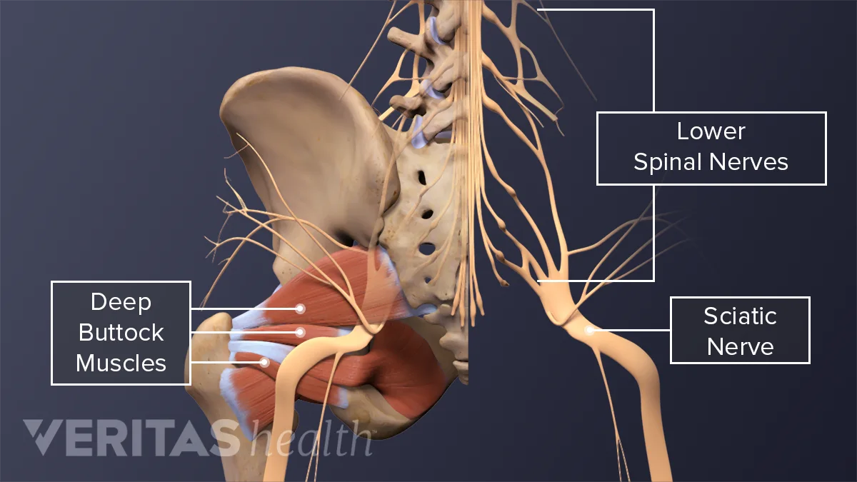 What Causes Buttock Muscle Pain and How to Relieve It Spine health