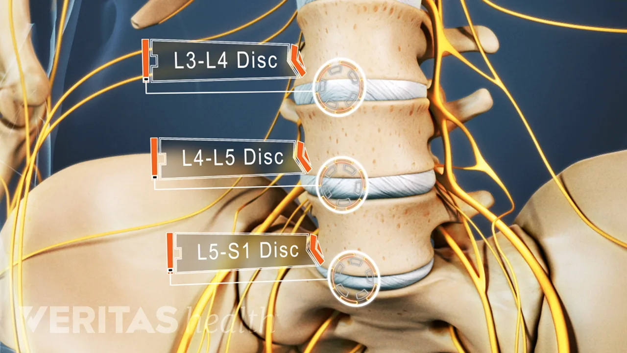 What Does L3 L4 Affect What Does L3 L4 Affect