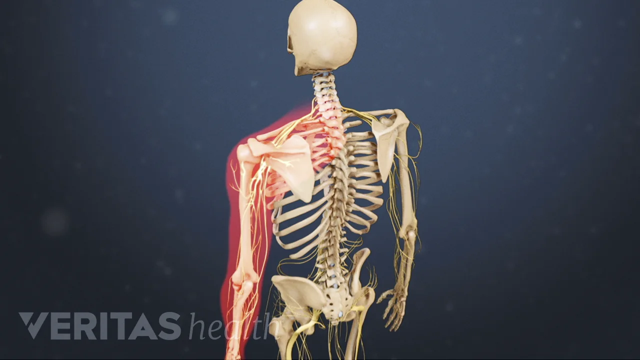 Top of shoulder neck pain sale
