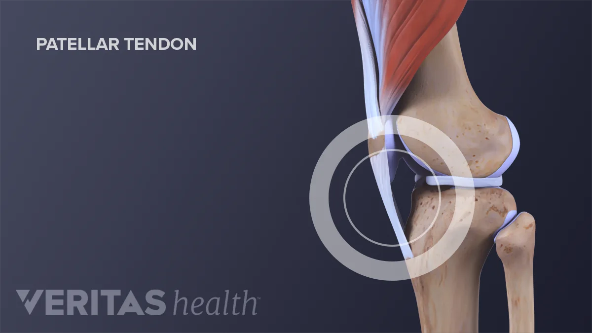 Symptoms of an Acute Patellar Injury Sports health