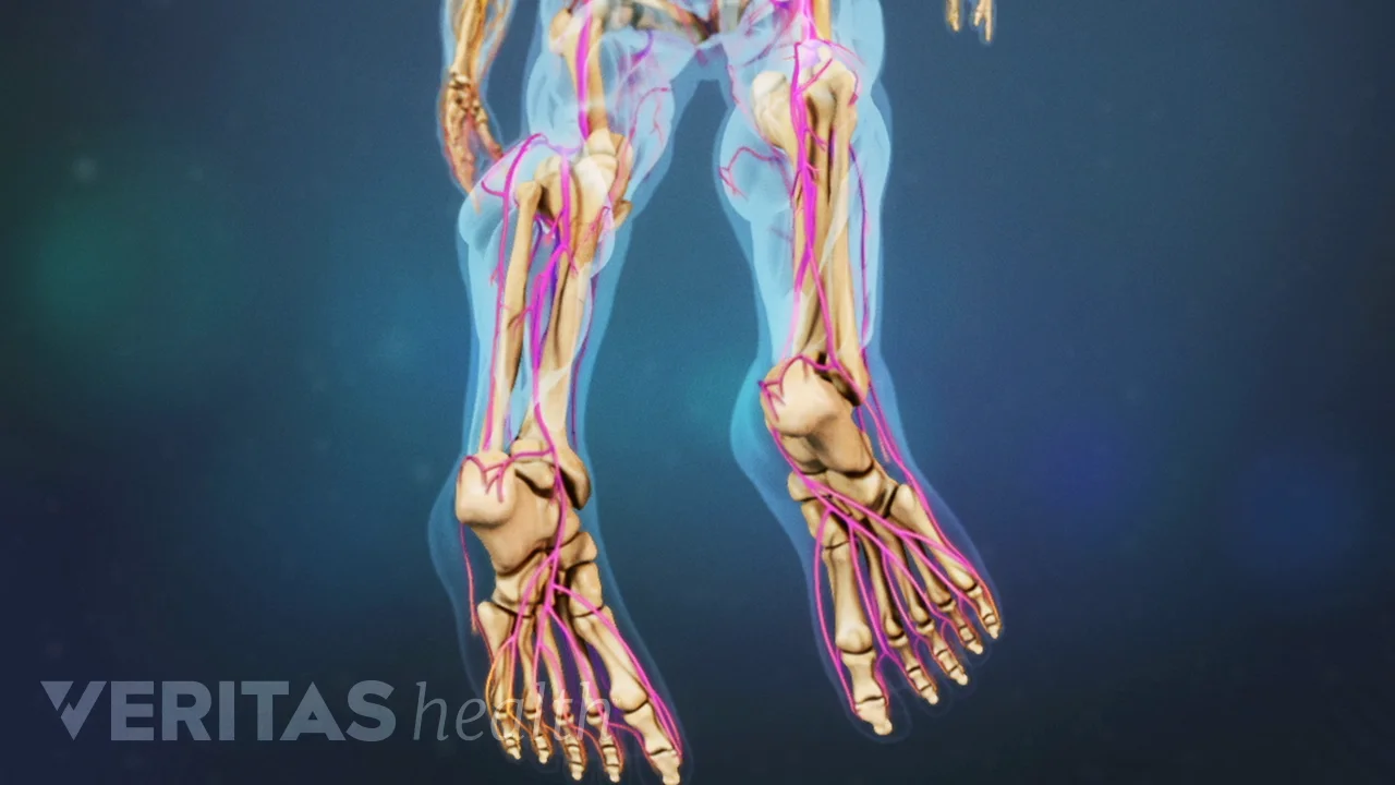 Common Causes of Foot Drop | Spine-health