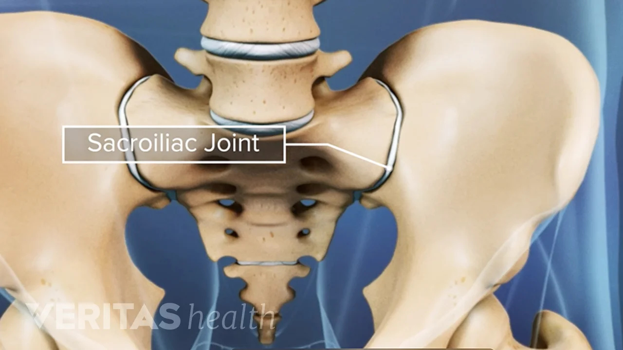 Sacroiliac (SI) Joint Anatomy Video | Spine-health