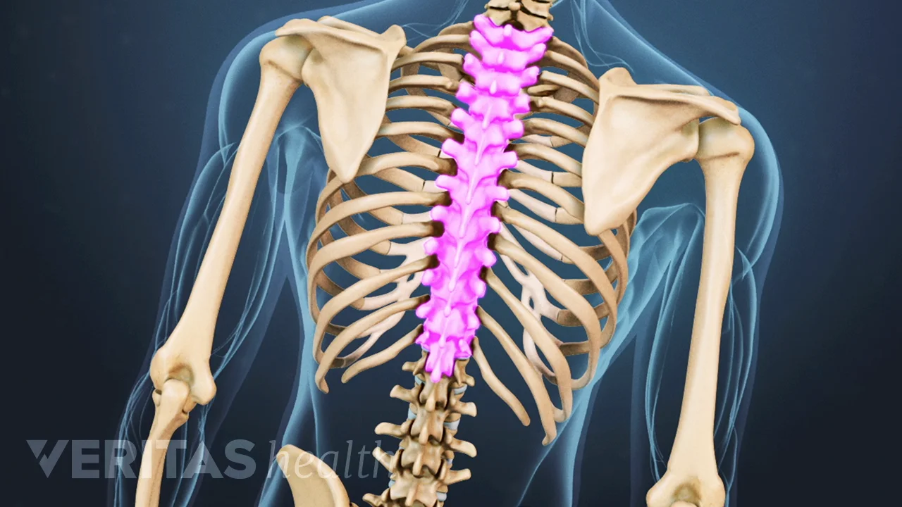 Spinal Tumor | Spine-health