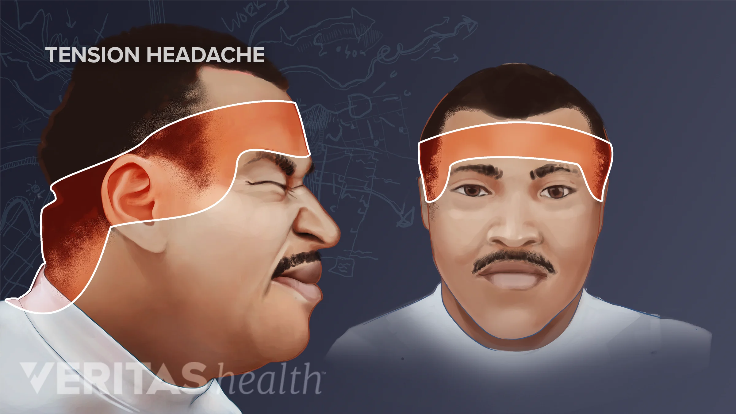 Neck Pain and Tension Headache | Spine-health